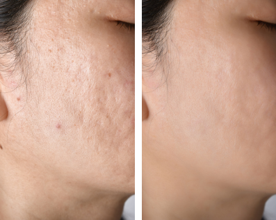 Yumi: 4 weeks with Restora